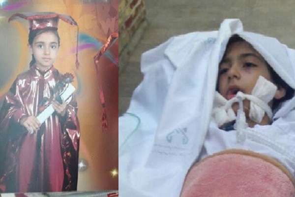 سهل انگاری پزشکان دختربچه ۸ساله قمی را به کام مرگ کشاند
