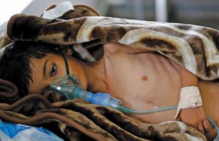 یمن، در معرض نسل کشی