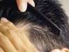 کشف یک مکانیسم جدید برای رشد مو با سلول های بنیادی