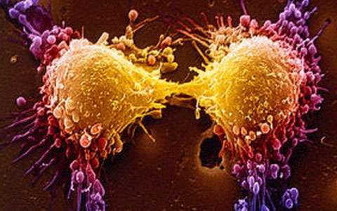 «رگ‌زایی» می‌تواند رشد سلول‌های سرطانی را مهار کند