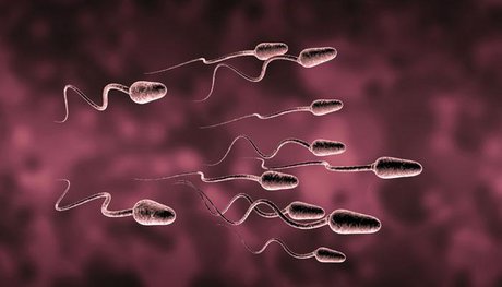 رابطه شاخصه‌های اسپرم با میزان PLC و اثر آن در مردان نابارور
