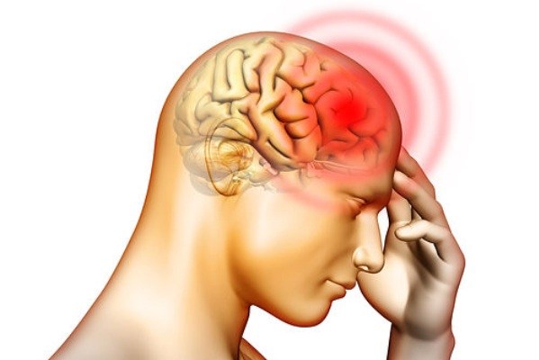 شایع ترین علل سر درد + خطرناکترین!