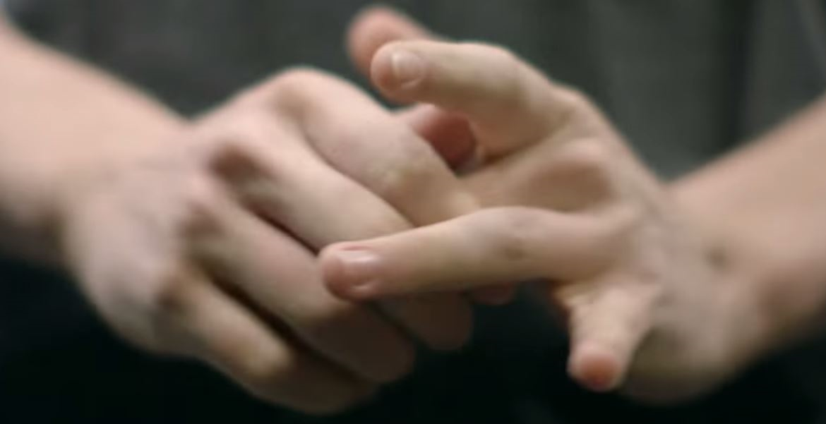شکستن انگشتان دست؛ مضر یا بی‌ضرر؟