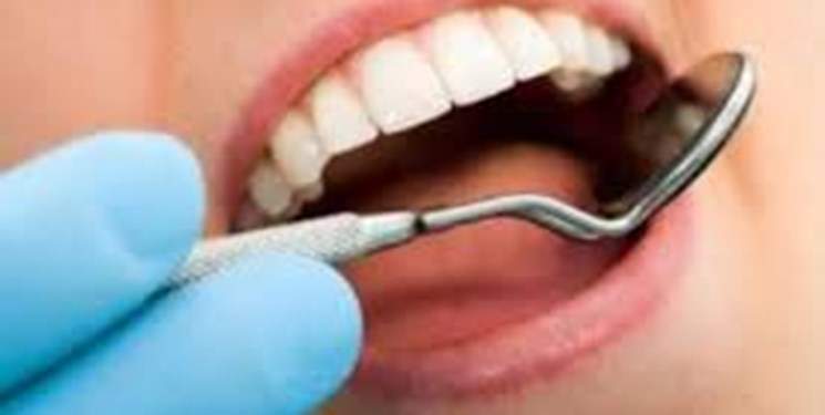 وجود ۲۰۰میلیون «دندان پوسیده» در دهان ایرانیان