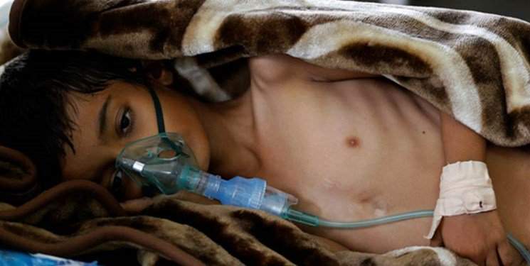 آغاز موج جدید وبا در یمن به دلیل محاصره سعودی