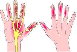 علت احساس درد در انگشتان و دست چیست؟